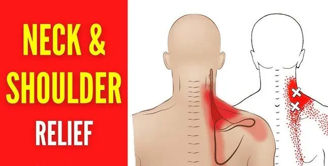 ¿Puede el dolor de hombro causar dolor de cuello?