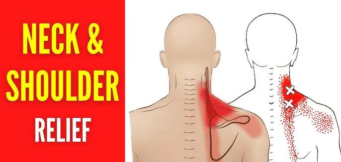 Can Shoulder Pain Cause Neck Pain